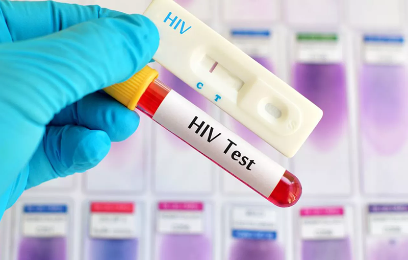 Zimbabwe attains HIV epidemic control: President