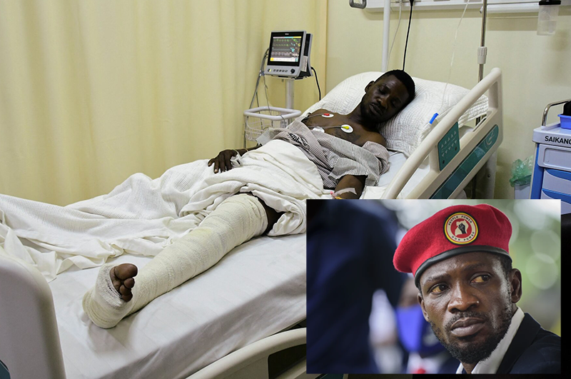 Uganda opposition leader Robert Kyagulanyi Ssentamu, known as Bobi Wine, lies in bed at St. Francis Hospital after he was injured by a teargas canister when police fired at his convoy in Kampala, Uganda