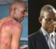 Authorities must investigate brutal attack on Madhuku- Amnesty International