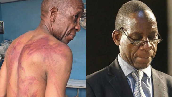Authorities must investigate brutal attack on Madhuku- Amnesty International